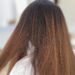 Hair Thinning – Hair Health