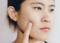 A Deep Dive into Skin Blemishes and Their Treatments